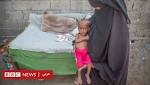 أزمة اليمن: "موت ألف طفل"