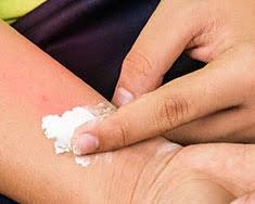 Image of Baking Soda for Insect Bites