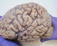 Image of Human brain