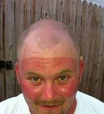 Image result for tennis tan lines