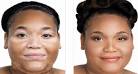 Vitiligo makeup products