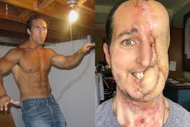 THE FACE THAT CAME BACK: TIM McGRATH’S JOURNEY THROUGH LOSS, SURGERY ...