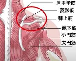 棘上筋の画像