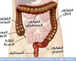 صورة الأمعاء الغليظة (جهاز هضمي)