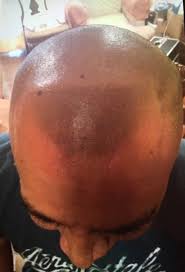 Resultado de imagen para dihidroxiacetona 3d