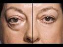 FOREVER BEAUTIFUL : Banish eye bags for good Daily Mail Online