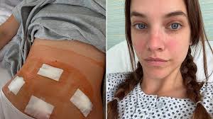 Matthew Perry's 'Ketamine Queen' Pleads Guilty! Shocking Details Revealed! - Imagen principal del artículo