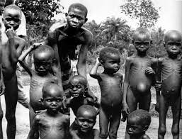 Image result for starving people