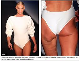 Afbeeldingsresultaat voor cellulite