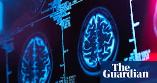 Allegations of Brain Illness Cover-up: Second Canadian Scientist Speaks Out - 1