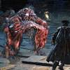 Story image for 1/3 Umbilical Cord Bloodborne Location from IGN