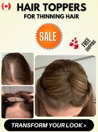 Image result for Hair toppers Canada
