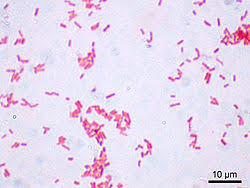 Resultado de imagen de bacterias microscopio optico