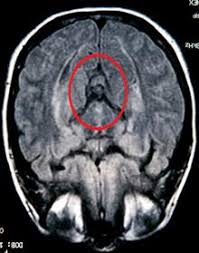 Résultat de recherche d'images pour "pareidolia"