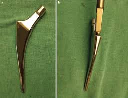 Femoral Stems in Total Hip Arthroplasty | Springer Nature Link