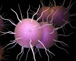 Image of Gonorrhea STI