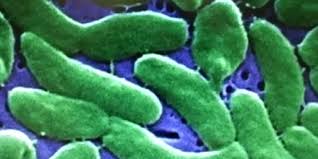 5 dead, 9 hospitalized in La. vibrio bacteria outbreak