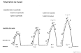 Contractions de travail : partir la maternit - m