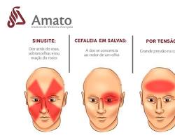 Imagem de Enxaqueca