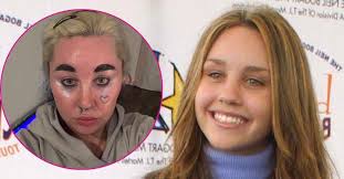 Amanda Bynes Unrecognizable After Cosmetic Procedures