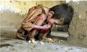 Image result for starving people