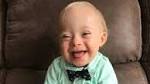  Lucas was just named 2018 Gerber baby. He has Down syndrome.