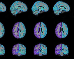 Imagem de medical imaging analysis