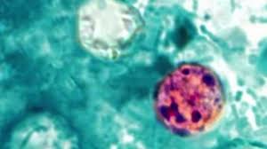 Michigan Cyclosporiasis outbreak tops 700 cases as health officials search for source