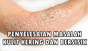 Hasil carian imej untuk masalah kulit kering