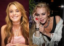 Image result for before and after meth