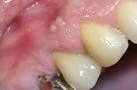 Abcs gingival : questions rponses sant - m
