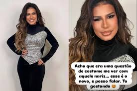 Simone Mendes brinca com críticas ao nariz após rinomodelação: "Deixa o povo falar"