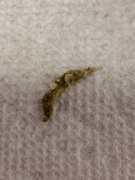 Help Identify this Worm | Reef2Reef
