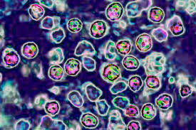 Two people in Pennsylvania have died from measles
