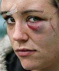 Katy Perry Wellington moshpit brawl ... - 4992190