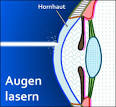 Welche Kosten kommen auf mich zu? - Lasik Augsburg Scharf