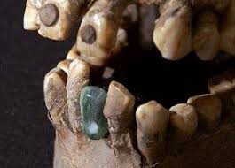 The earliest forms of dentistry were developed by Ancient Mayan and Aztec dentists over 2,500 years ago. They would drill out small holes on teeth to set small gems and other semi