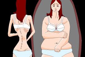 Resultado de imagen de anorexia y bulimia