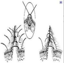Image result for simple continuous suture pattern