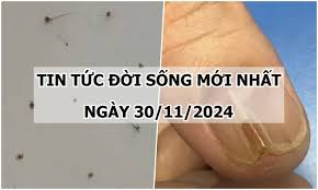 Tin tức đời sống 30/11/2024: Hãi hùng rận bám chi chít trên mi mắt người phụ nữ