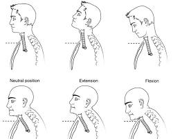 Image de Neck flexion and extension
