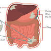 Story image for Peritoneal Mesothelioma Causes from Mesothelioma.com