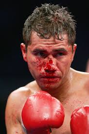 Ivan Hernandez readys himself before the start of the 4th round against Israel Vazquez during their WBC Super Bantamweight Championship fight ... - Light%2BHeavyweight%2BFight%2BAntonio%2BTarver%2Bv%2BBernard%2BSO7r4Wd5DCwl