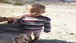 ظهور وباء شبيبة بالكوليرا يصيب