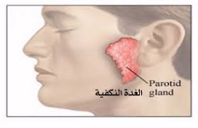 مرض الغده النكافيه يدخل قرية(دروه)مركز ملوى-محافظة المنيا للمره الأولى