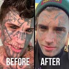 Ethan Bramble has 98% of his body tattooed - but he's now ...