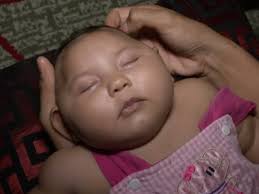 Image result wey dey for images of zika babies\