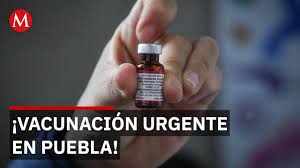 Confirman primer caso de sarampión en Puebla: activan alerta