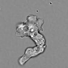 Científica Descubre Dos Nuevas Especies de Ameba en Laboratorio Improvisado en un Motel