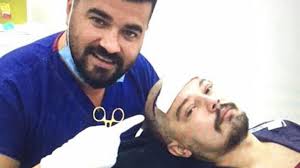 Image result for saç ektiren milletvekilleri